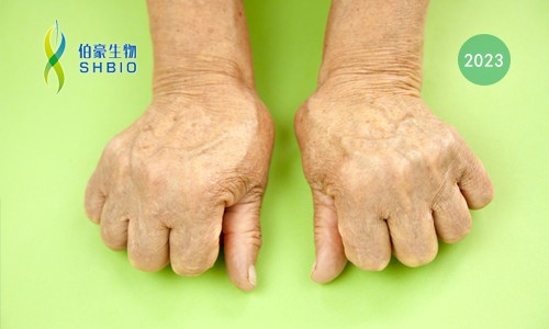 高分文獻(xiàn)一作分享會 | 時空組學(xué)技術(shù)助力發(fā)現(xiàn)類風(fēng)濕關(guān)節(jié)炎疾病治療新靶點(diǎn)